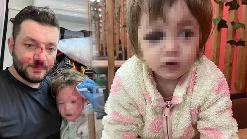 Scooterlı caniye jet iddianame! Kucağındaki bebekle babayı hedef almıştı!