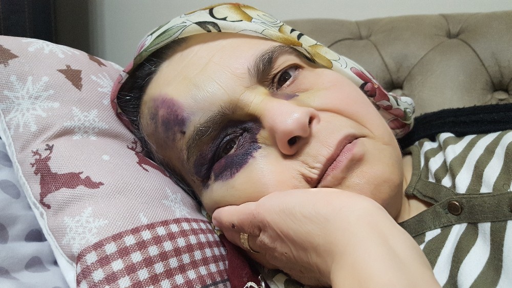 Şehir zorbası yaşlı çifti öldüresiyle dövdü 