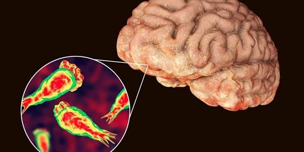 Şehirdeki tüm fıskiyeler kapatıldı! ABD'de beyin yiyen amip paniği: Bir çocuk hayatını kaybetti