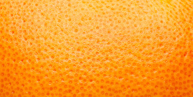 Selülit'e birebir gelecek bitkisel tedavi yöntemleri!