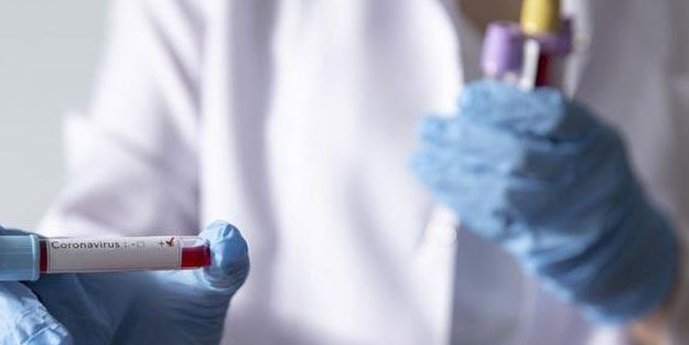 Senegal'de koronavirüs vaka sayısı 50'yi geçti