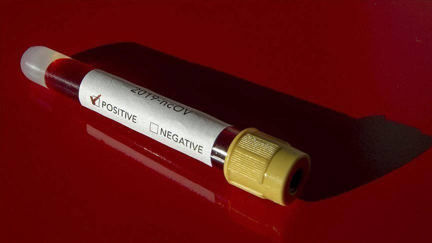 Senegal'de Kovid-19 bulaşan kişi sayısı 34'e yükseldi