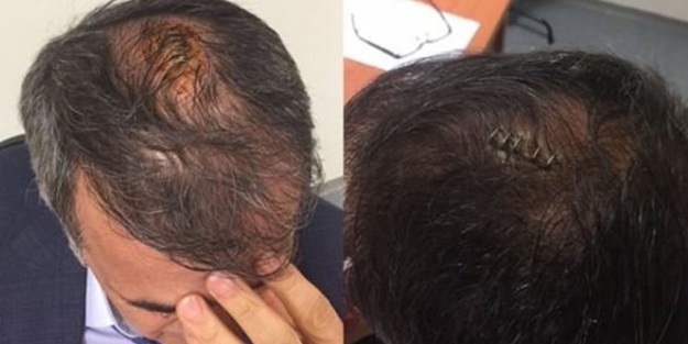 Şenol Güneş'e müdahale eden doktor konuştu