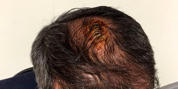 Şenol Güneş'in kafasına 5 dikiş atıldı