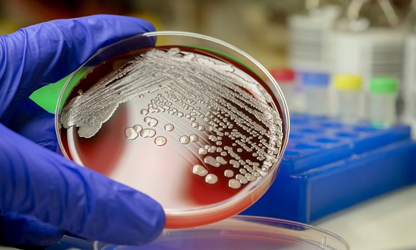 Sepsis nedir? | Koronavirüs sepsis ne demek?