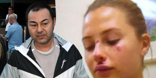 Serdar Ortaç’ın eşi Chloe’nin sağlık durumu nasıl?