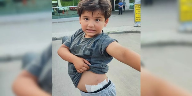 Sevmek istediği köpeğin saldırısına uğradı! 8 yaşındaki çocuk yaralandı