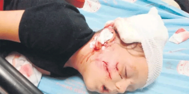 Sevmek istediği köpek ağır yaraladı: Çocuğum dışarı çıkamıyor