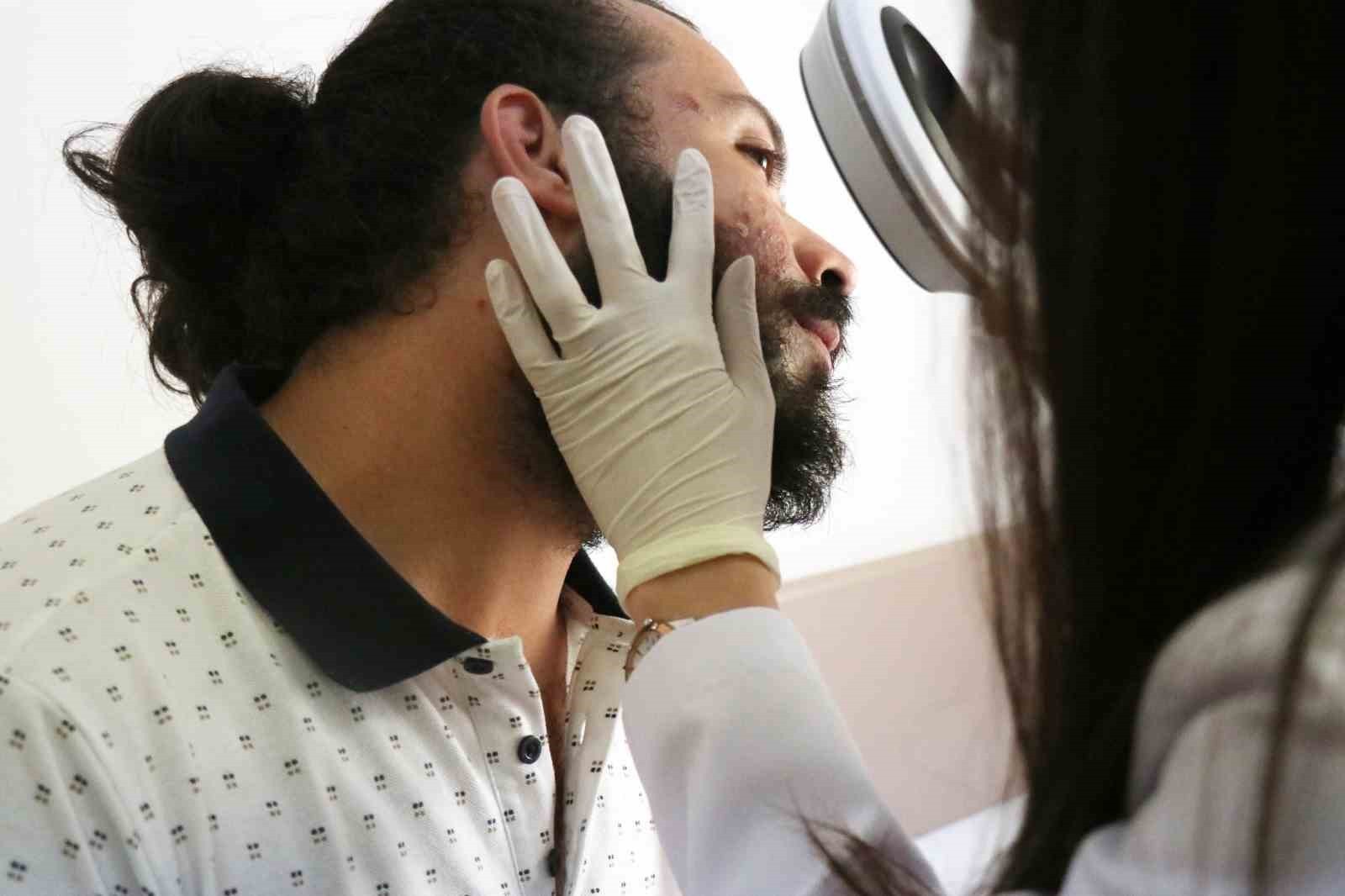 Sıcak havalar cilt hastalıklarını tetikledi: Herkes hastaneye koştu