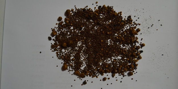 Şiddetli karın ağrısı şikayetiyle gitti! 4 bin 536 tane çıkarıldı