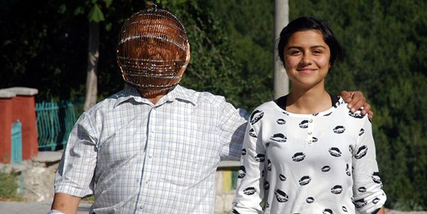 Sigara içmemek için kafasına kafes taktı