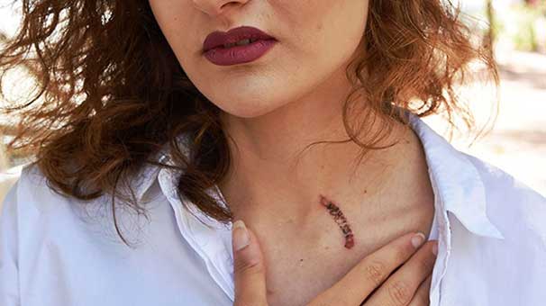 Sigaralı saldırgan beraat istedi