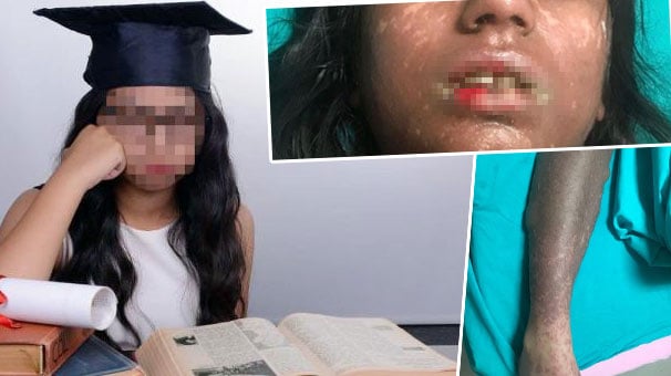 'Sınav stresim var' diyerek doktora gitti, bu hale geldi