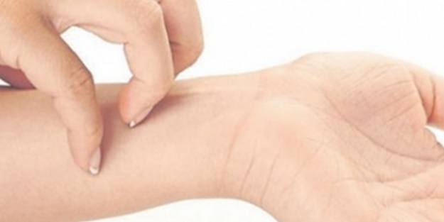 Sinek ısırığını geçirmek istiyorsanız...