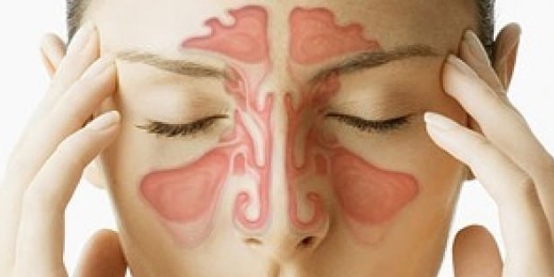 Sinüziti başka hastalıklarla karıştırmayın
