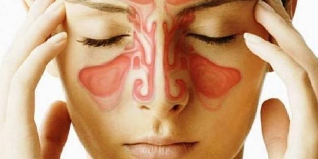 Sinüzitin belirtileri nelerdir?