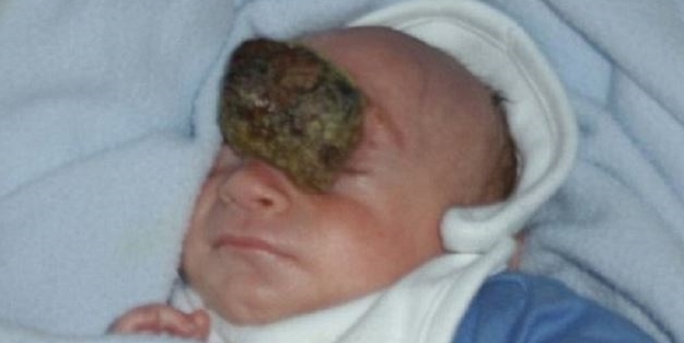 Sıra dışı olay! Beyni dışarıda doğdu!