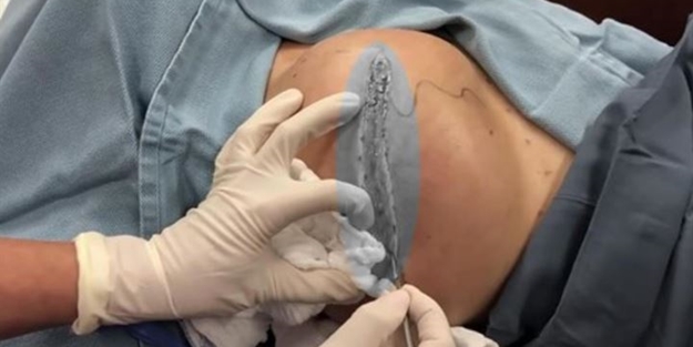 Sırtından çıkanlar hayrete düşürdü