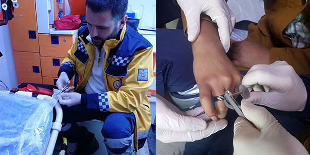 Şişen parmaktaki yüzüğü böyle çıkardılar