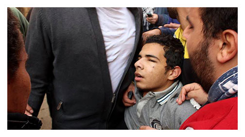 Sisi cuntası kanla besleniyor