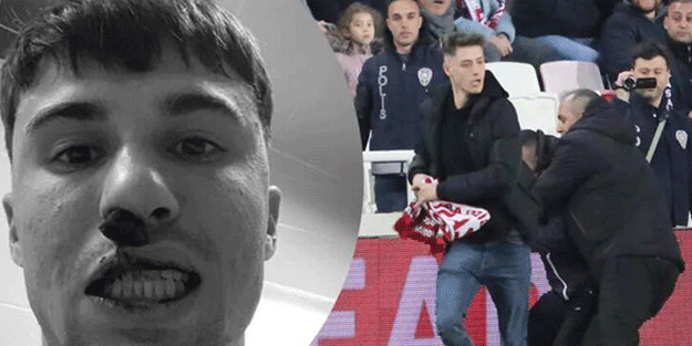 Sivas taraftarının burnunu kırdığı Bianco ameliyat olacak!