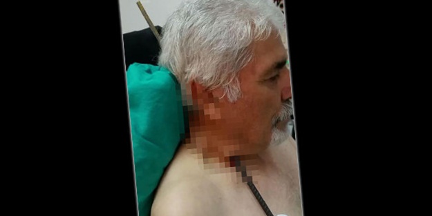 Sivas'ta korkunç kaza! Boynuna saplandı