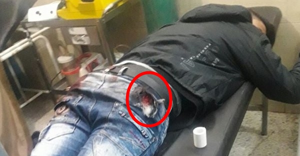 Sivil kıyafetli terörist vurularak etkisiz hale getirildi