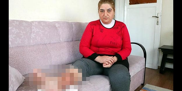 Sivilce hayatını kararttı! Bacaklarının kesilmemesi için 60 bin TL'ye ihtiyaç var