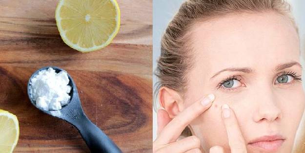 Sivilce neden olur, nasıl geçer?