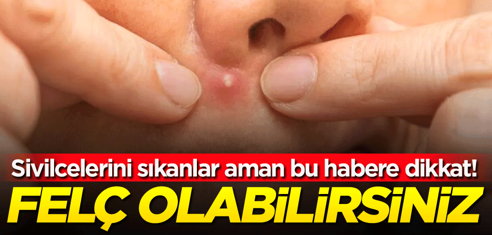 Sivilcelerini sıkanlar aman bu habere dikkat! Felç olabilirsiniz
