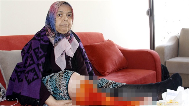 Sivrisinek ısırığı hayatını kararttı