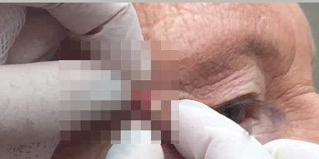 Siyah nokta sandı ama... - FOTO