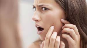 Siyah noktalardan kurtulmak mümkün mü?