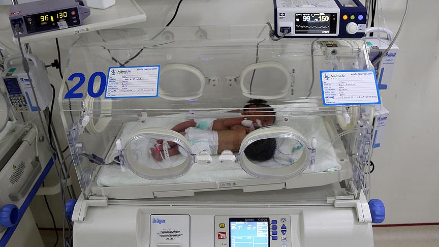 Siyam ikizleri ameliyatla birbirinden ayrıldı