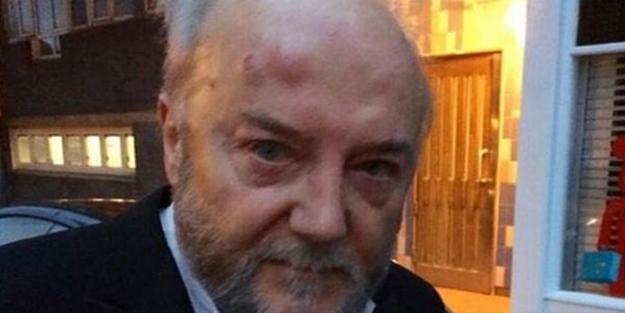 Siyonistlerden İsrail karşıtı vekile feci dayak!