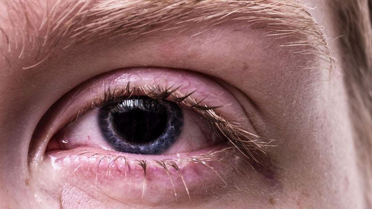 Siz siz olun bunu sakın yapmayın! Görme kaybına yol açıyor