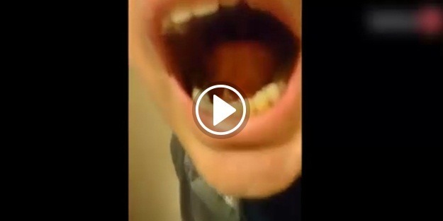 Sizin ağzınızda da olabilir! Korkunç görüntü...