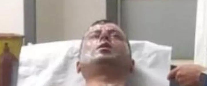 Sizin de başınıza gelebilir! Lavabo açıcı kullananlar dikkat