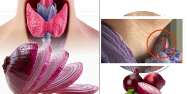 Soğanı boyna bağlamanın inanılmaz faydaları! Soğan hangi hastalığa iyi gelir?
