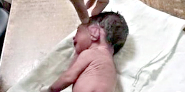 Şok ettiren bebek dünyaya geldi!