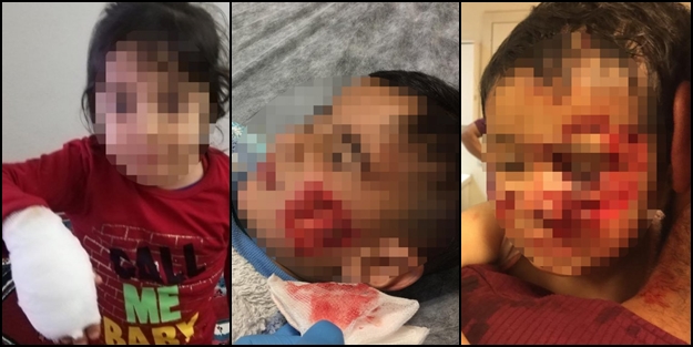 'Sokak köpeği' dehşeti: 6 küçük çocuğa saldırdı! Ölü ve yaralılar var