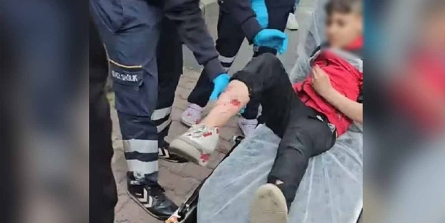 Sokak köpekleri 12 yaşındaki çocuğa saldırdı!