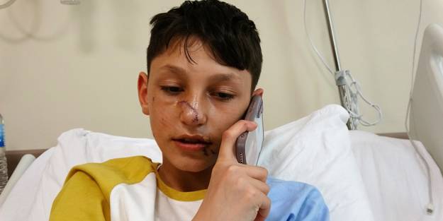 Sokak köpekleri dehşeti yaşatmıştı! Küçük çocukla ilgili yeni gelişme