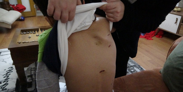 Sokak köpekleri okula giden çocuğa dehşeti yaşattı!