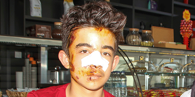 Sokak köpekleri yüzünden bu hale geldi