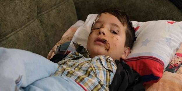 Sokak köpeklerinin ölümüne saldırdığı çocuk 36 gün sonra dışarı çıktı: Köpek gördüğü zaman...