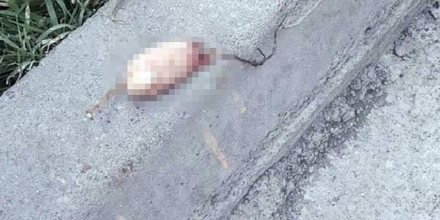 Sokakta bulunan ayak parmaklarının sahibi belli oldu