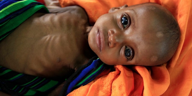 Somali'de şiddetli kuraklık ölüm ve sefalet getiriyor!