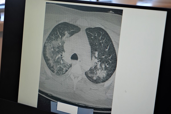 Son yıllardan bu yüzden artmış olabilir! Kalp krizi vakalarının sebebiyle ilgili korkutan açıklama