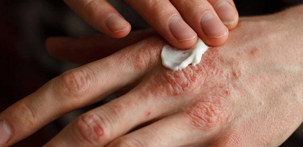 Sonbahar geldi belirtiler arttı